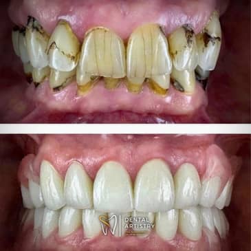 Slider image (1) Dental Artistry Dental Center